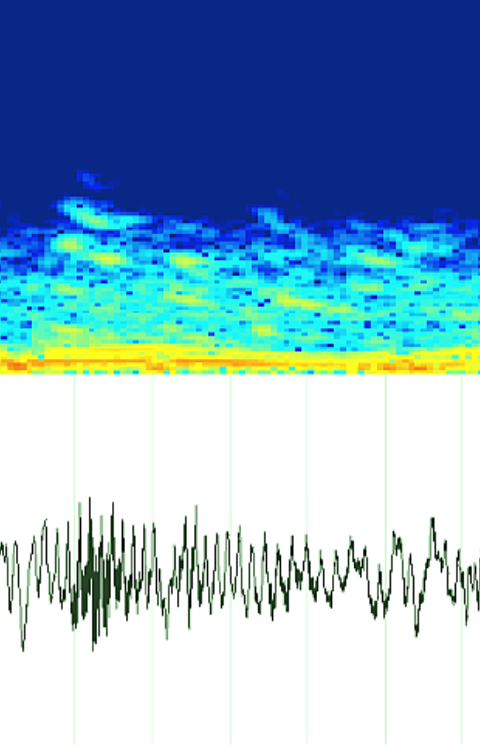 cough monitoring spectrogram - rhonchi