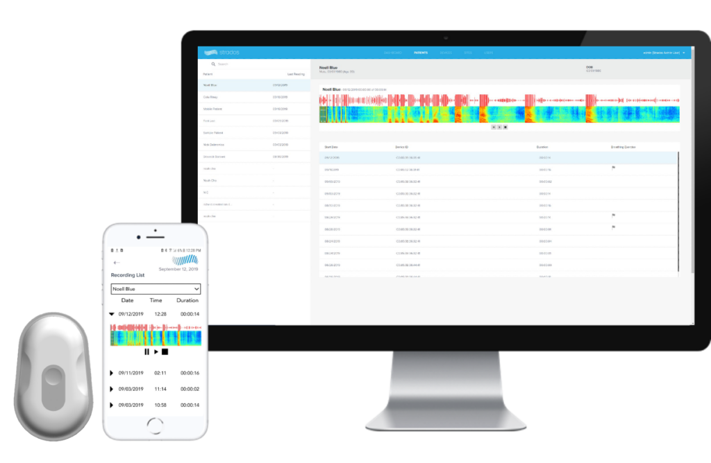 RESP remote monitoring