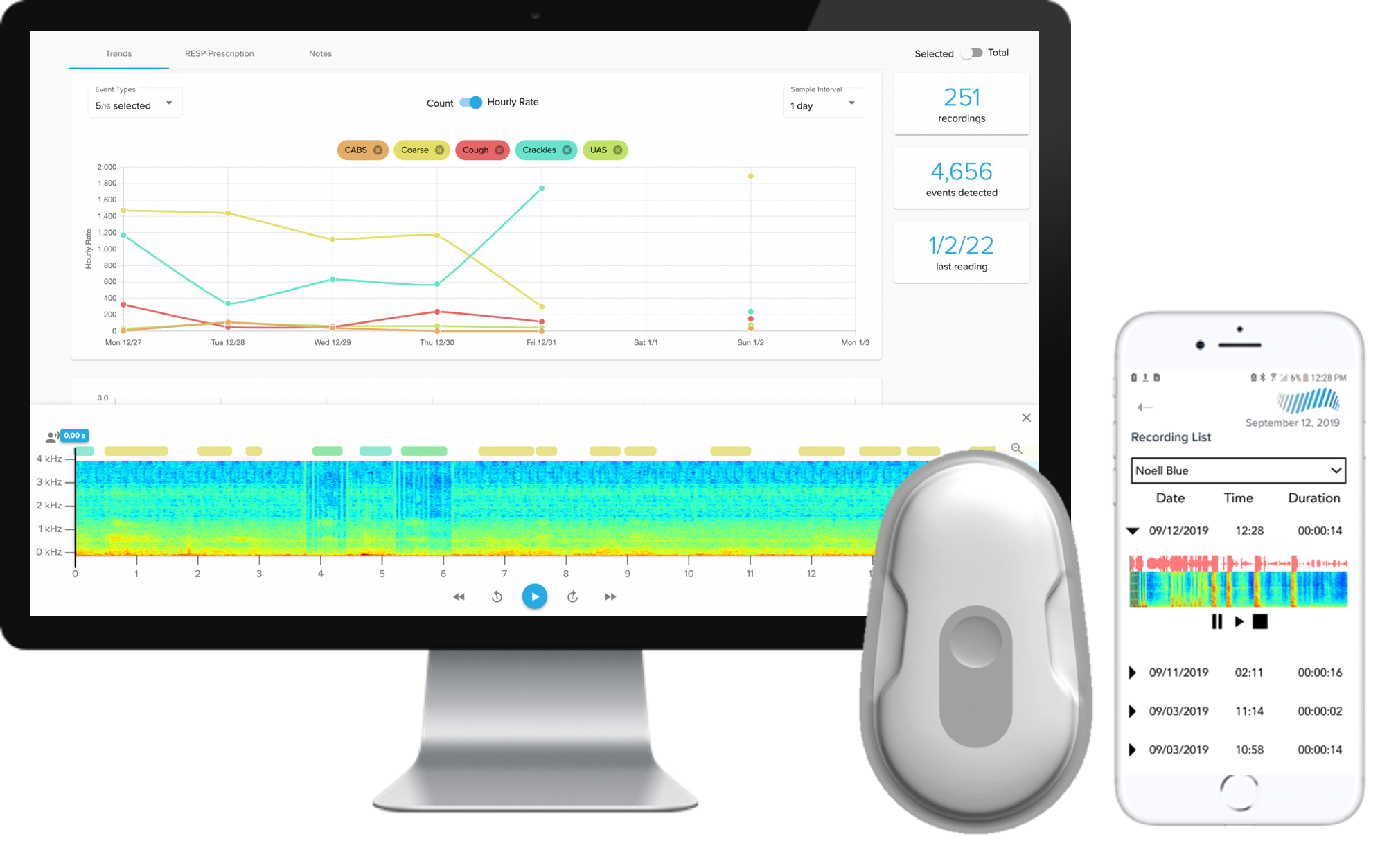respiratory monitoring devices - Strados RESP platform