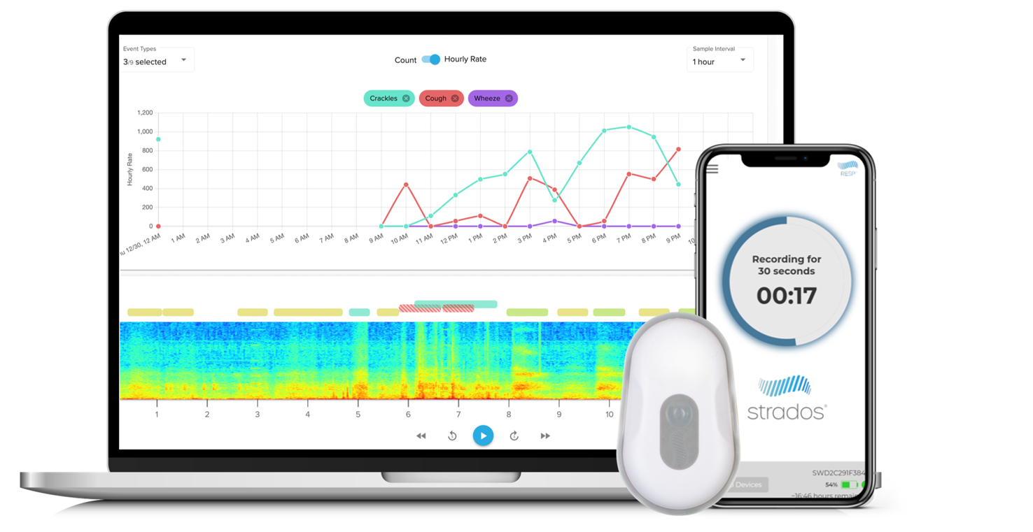 Wearable Asthma Monitoring Device - RESP Biosensor