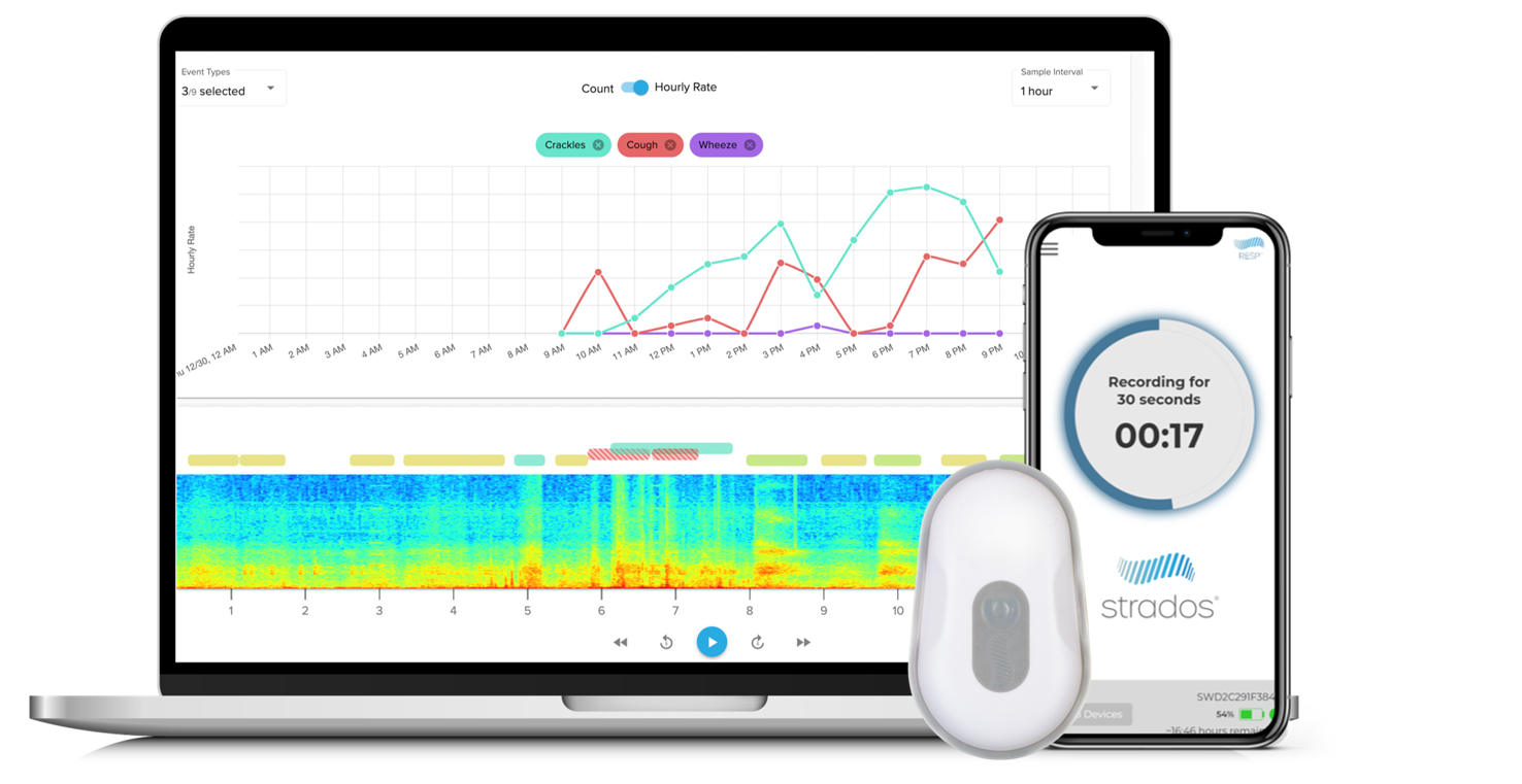 RESP Biosensor Cough Monitoring Device