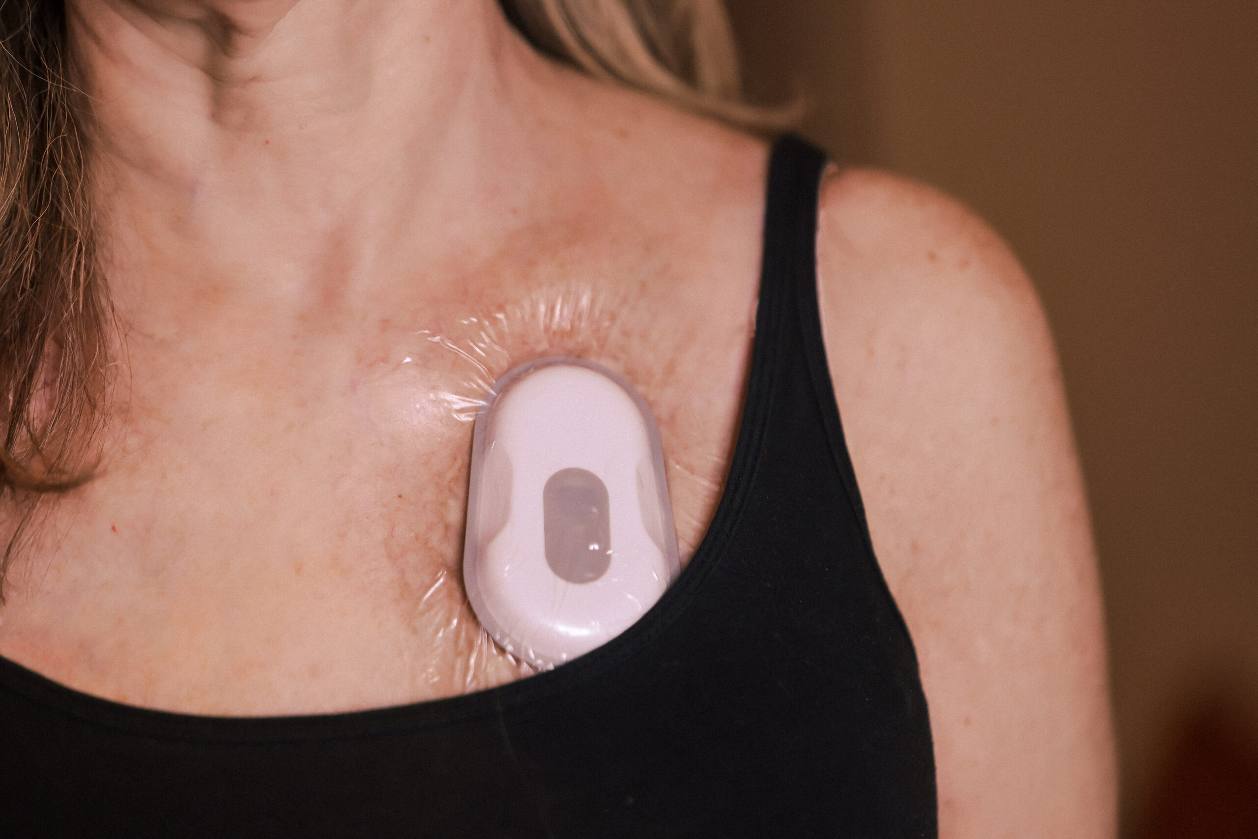 Wheeze Monitor & Asthma Monitoring Device