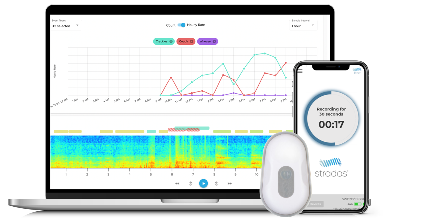 Wearable Respiratory Monitor - RESP